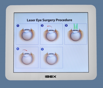 Laser Eye Surgery
